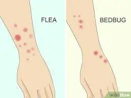 bed bugs
